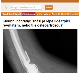 Kloubní náhrady: snáší je lépe lidé trpící revmatem, nebo ti s osteoartrózou?